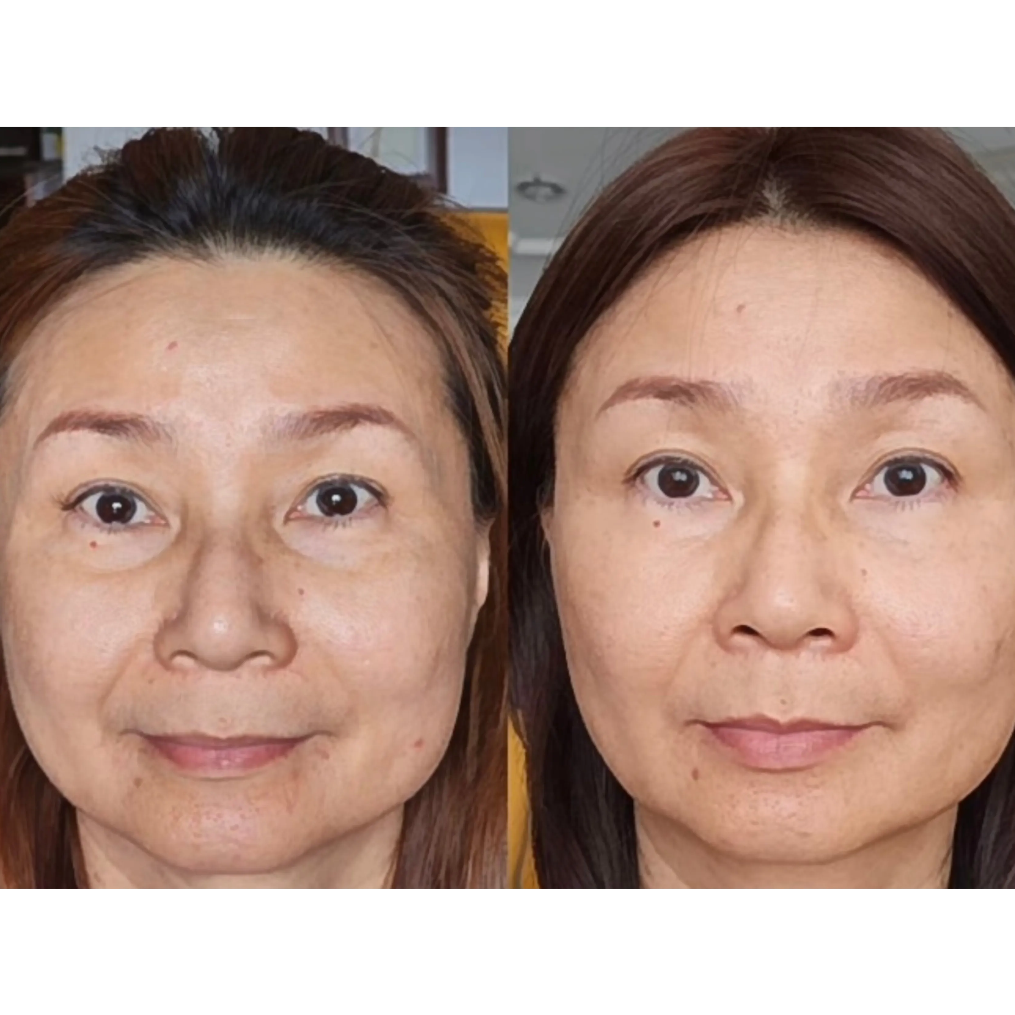 LP ageLOC Tru Face Peptide Retinol Complex Testimonial 1