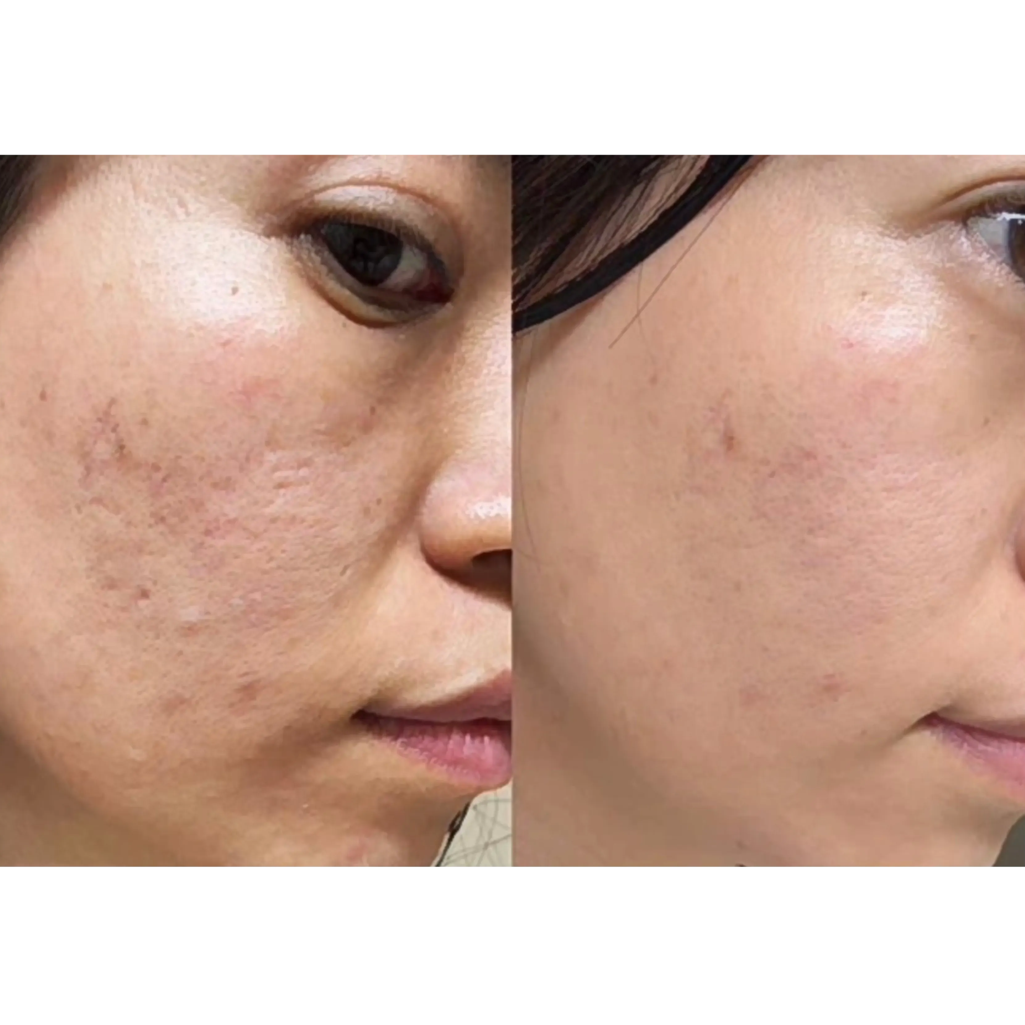 LP ageLOC Tru Face Peptide Retinol Complex Testimonial 3