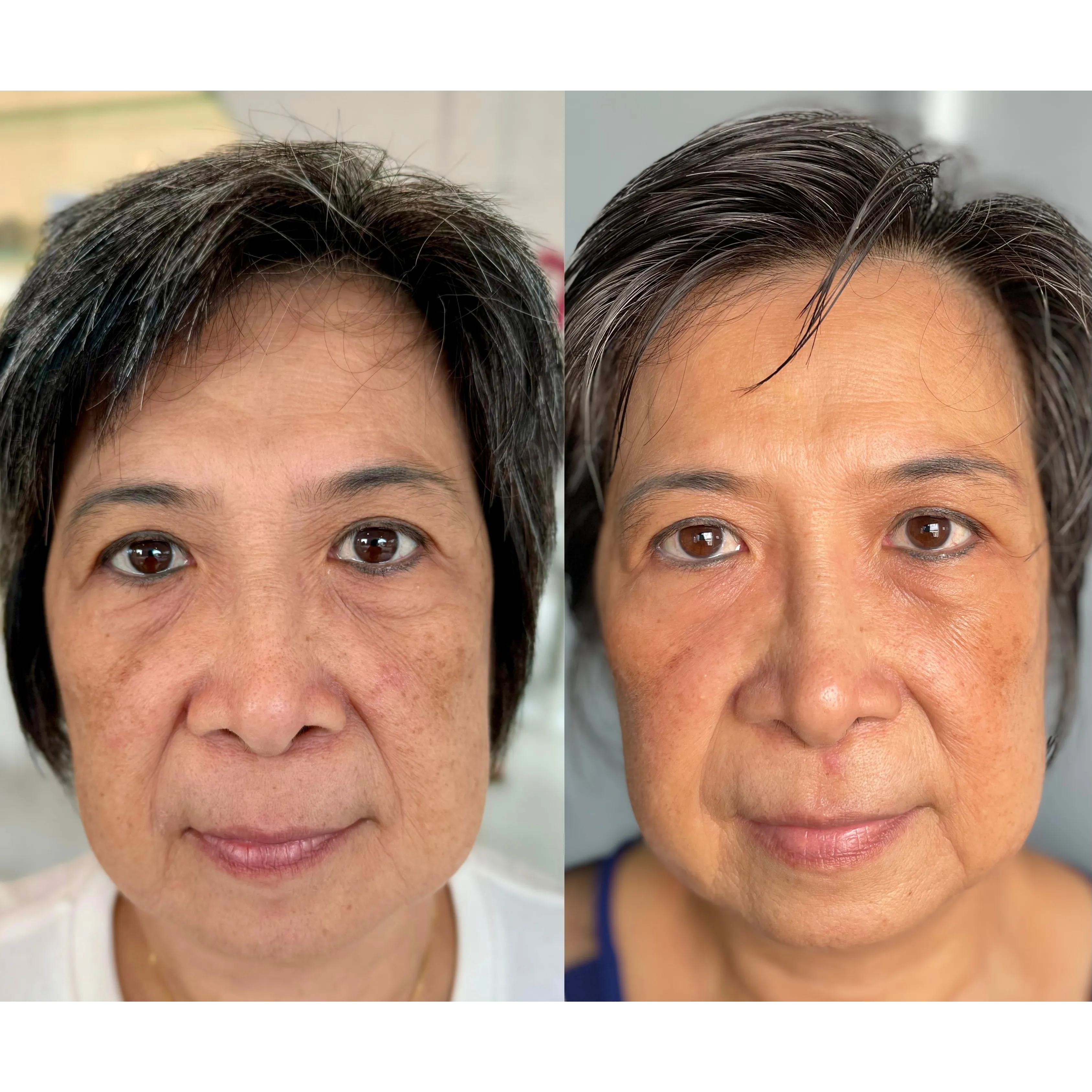 LP ageLOC Tru Face Peptide Retinol Complex Testimonial 4