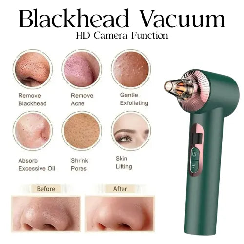 Side Product - Blackhead Removal HD Camera Function